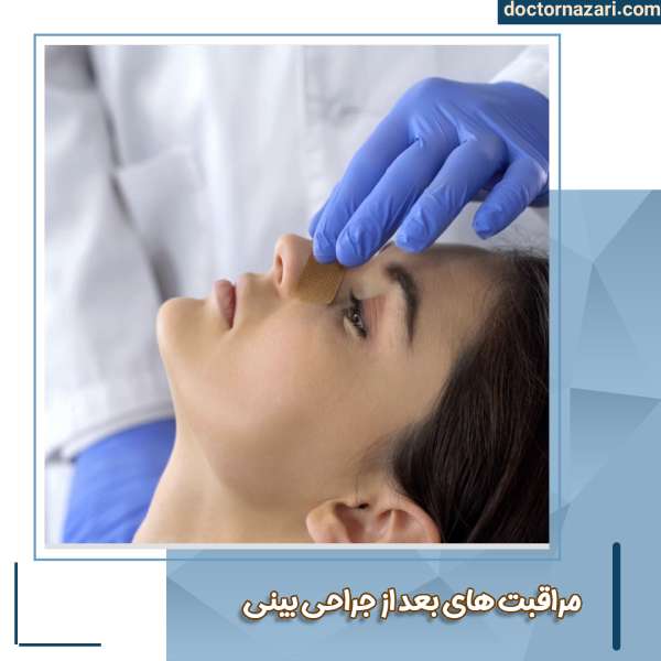 مراقبت های بعد از جراحی بینی