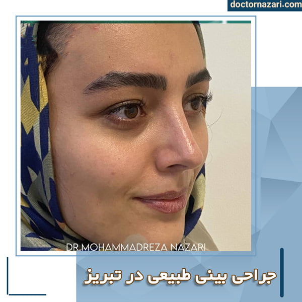 عکس بینی طبیعی