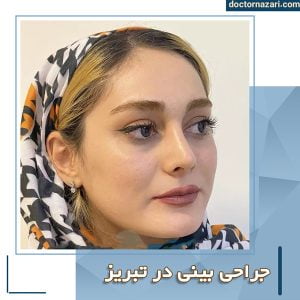 عمل بینی در تبریز + دکتر محمدرضا نظری
