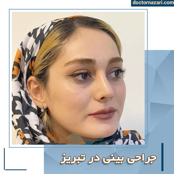 عمل بینی در تبریز + دکتر محمدرضا نظری