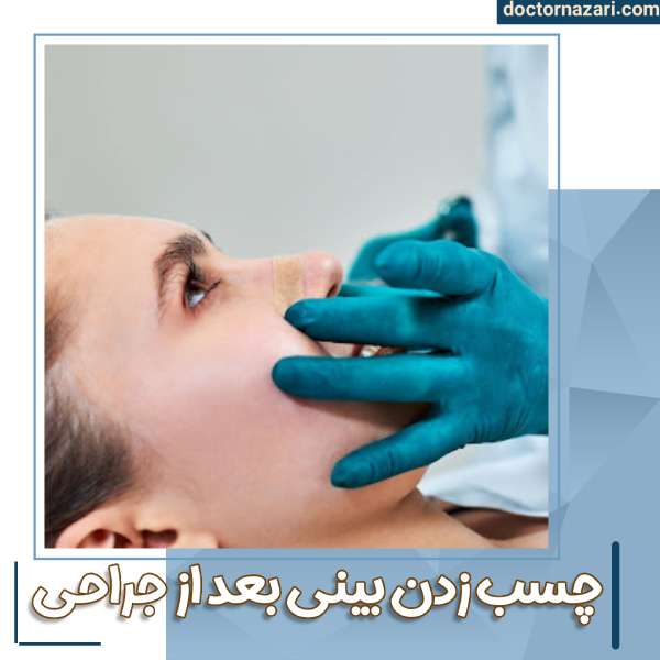 چسب زدن بینی بعد از جراحی