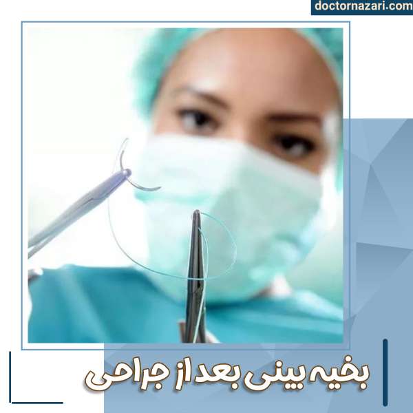 بخیه بینی بعد از عمل