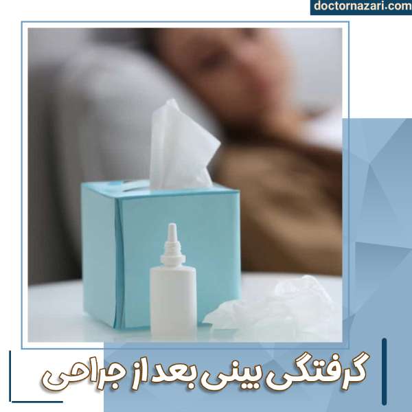 گرفتگی و کیپ شدن بینی بعد از جراحی