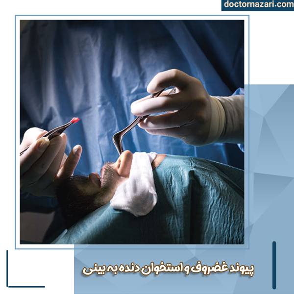 پیوند غضروف و استخوان به بینی