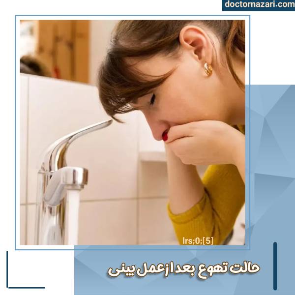 حالت تهوع بعد از عمل بینی
