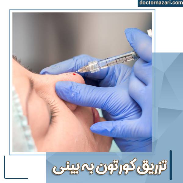 تزریق کورتون به بینی