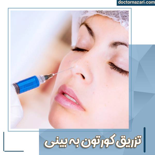 تزریق کورتون به بینی