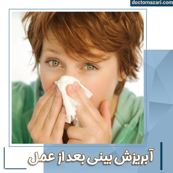آبریزش بینی بعد از عمل