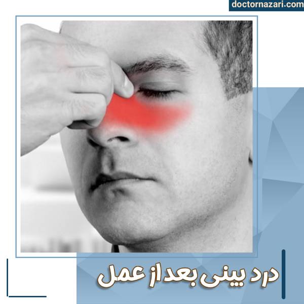 درد بعد از جراحی بینی