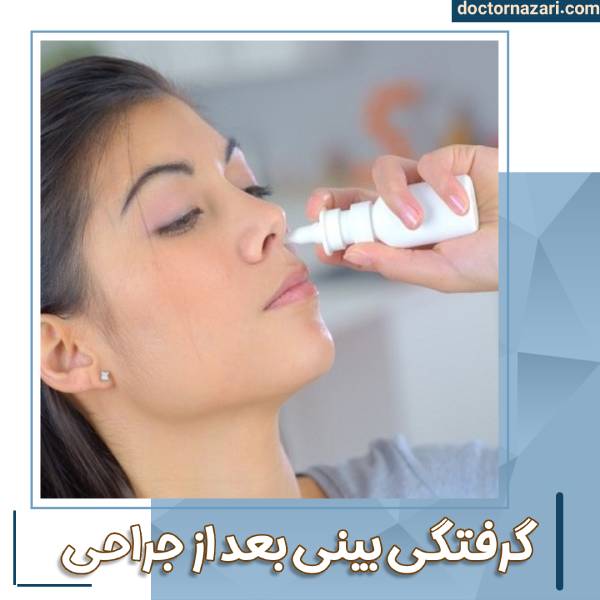 کیپ بودن بینی بعد از عمل