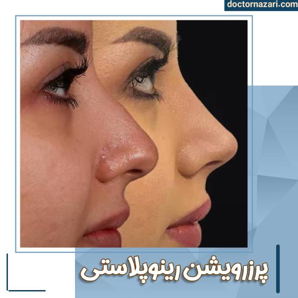 جراحی پرزرویشن در تبریز با دکتر محمدرضا نظری