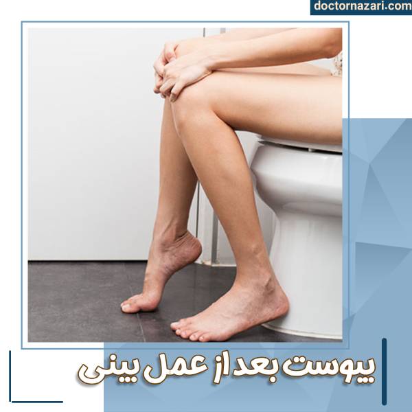 دستشویی رفتن بعد از عمل بینی