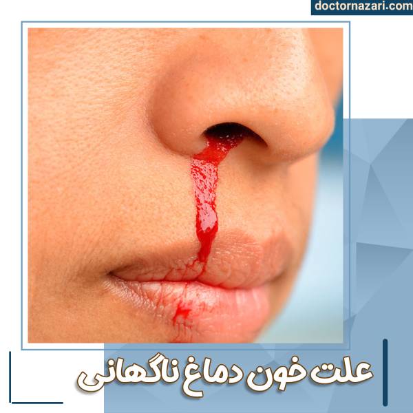 عکس خون دماغ از سوراخ راست بینی