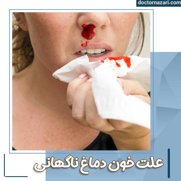 عکس خون دماغ ناگهانی