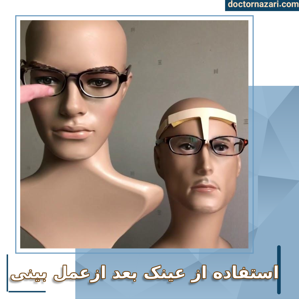 عینک زدن بعد از عمل بینی - دکتر محمدرضا نظری