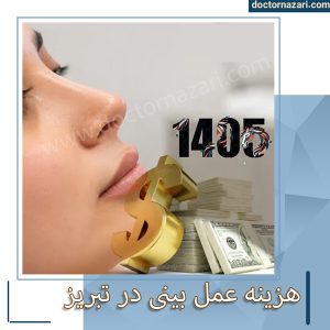 هزینه عمل بینی در تبریز - دکتر محمدرضا نظری