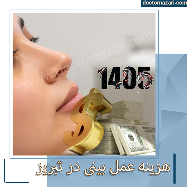 هزینه عمل بینی در تبریز - دکتر محمدرضا نظری