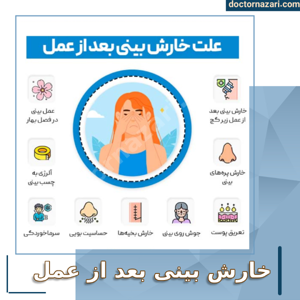 خارش بینی بعد از عمل با دکتر محمدرضا نظری
