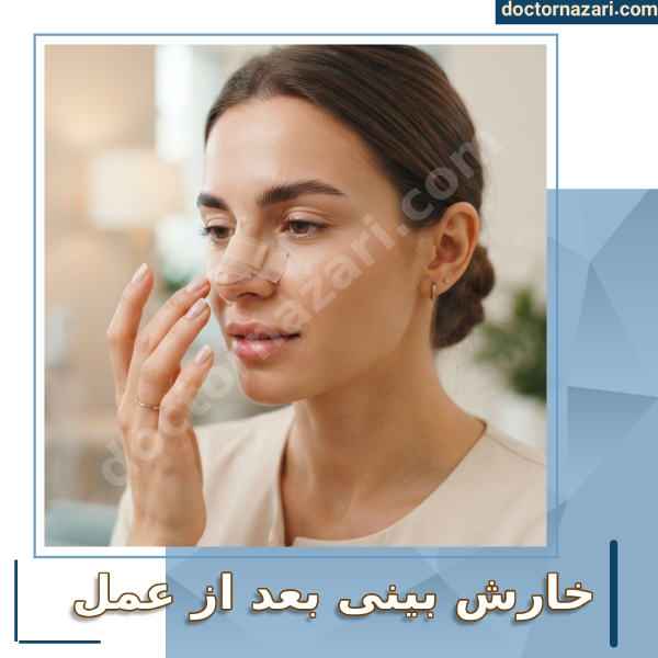 علت خارش بینی بعد از عمل با دکتر محمدرضا نظری